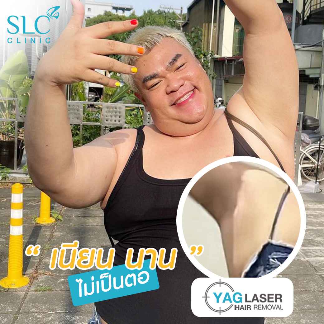  มูสกำจัดขน, เลเซอร์ขน, slc เลเซอร์ขน, เลเซอร์ขน yag, เลเซอร์ขน slc, slc clinic เลเซอร์ขน, กำจัดขน, gentle yag laser