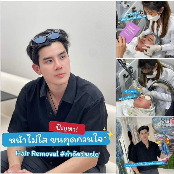  มูสกำจัดขน, เลเซอร์ขน, slc เลเซอร์ขน, เลเซอร์ขน yag, เลเซอร์ขน slc, slc clinic เลเซอร์ขน, กำจัดขน, gentle yag laser