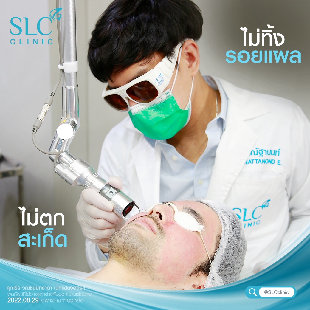 Pico Plus Laser, เลเซอร์หน้าใส