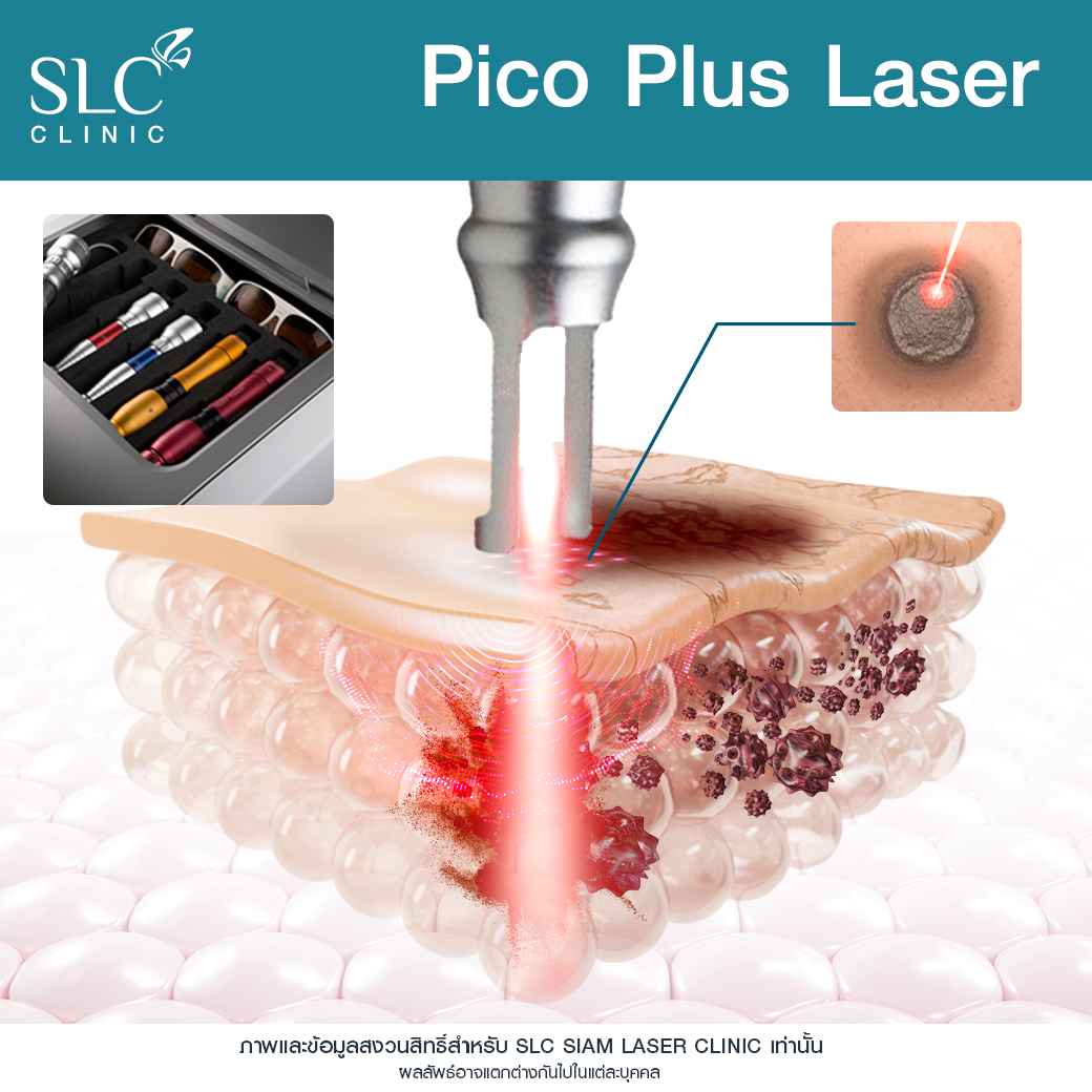 Pico Plus Laser, เลเซอร์หน้าใส