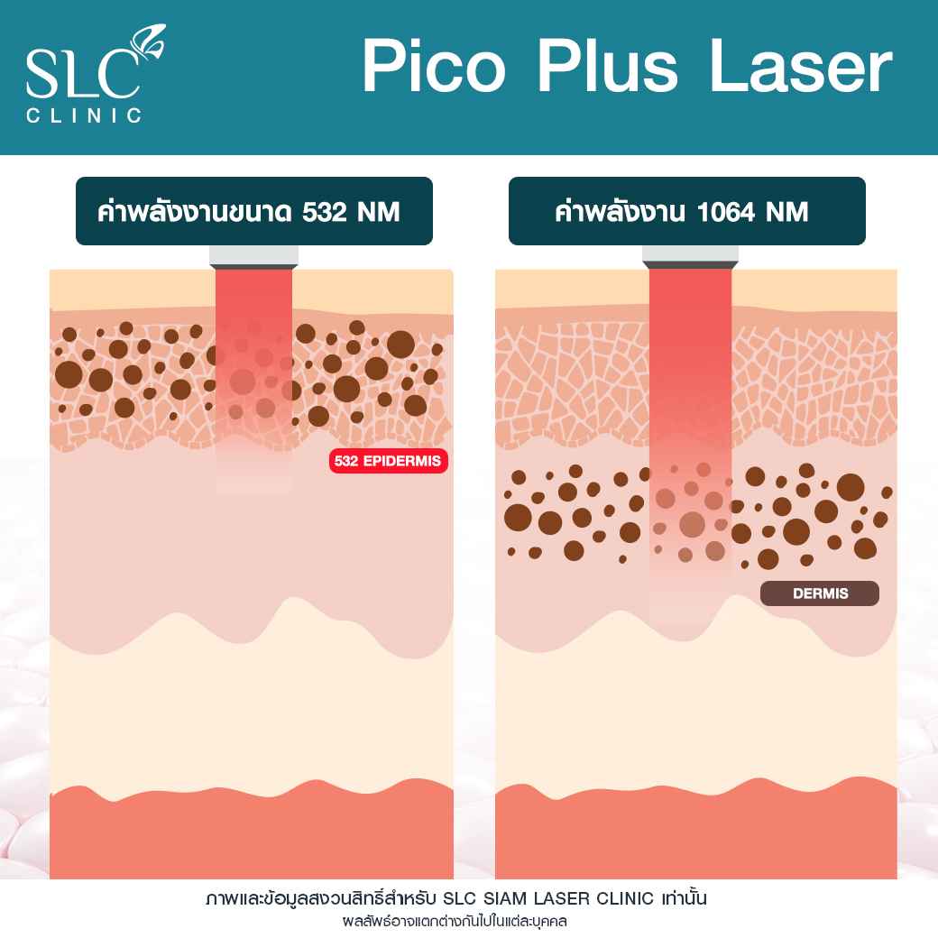 Pico Plus Laser, เลเซอร์หน้าใส