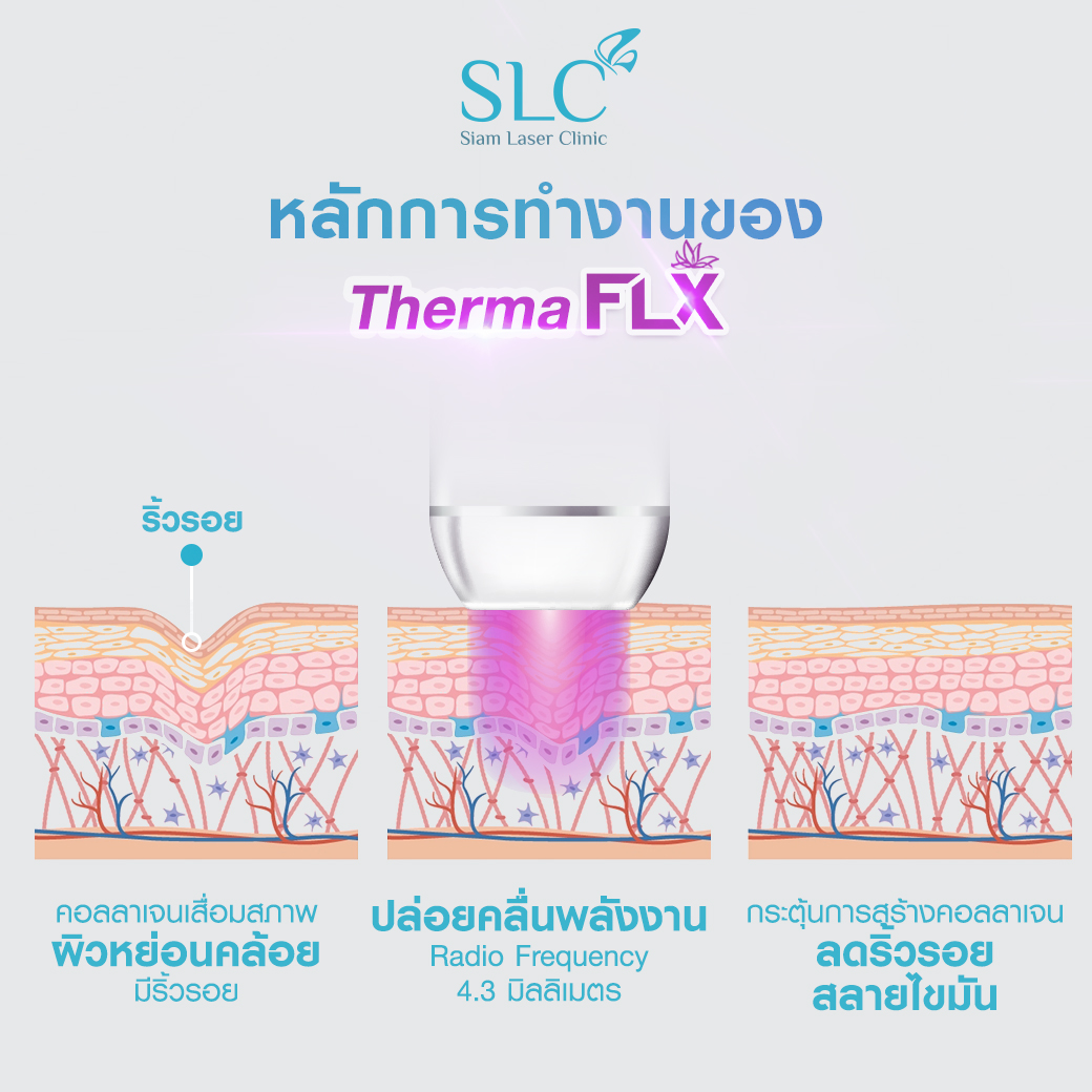 ยกกระชับ Thermage FLX