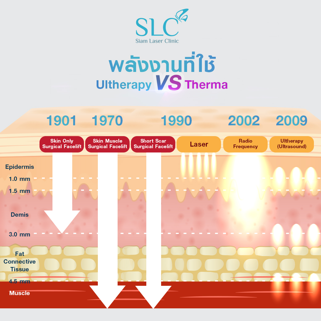 ยกกระชับ Thermage Ultherapy