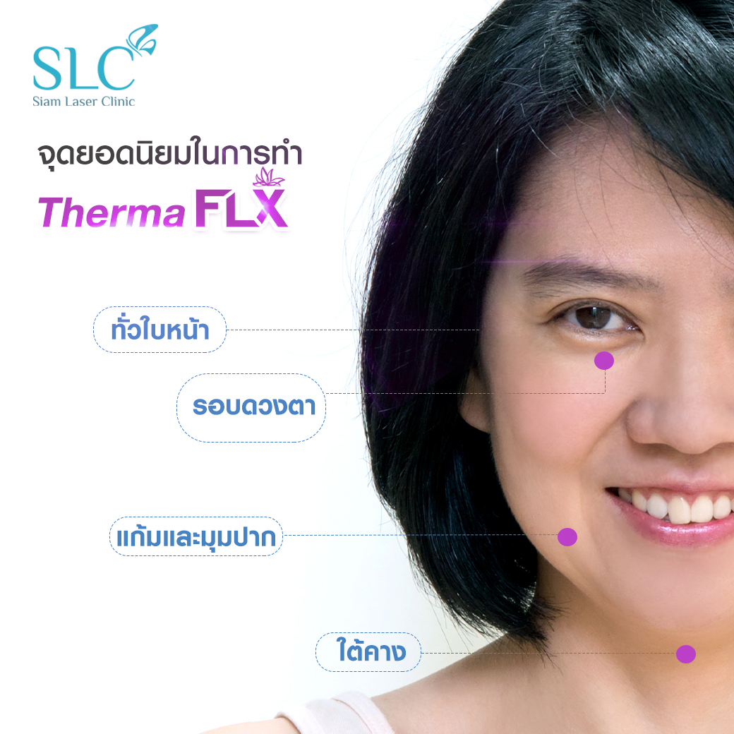 ยกกระชับ Thermage FLX