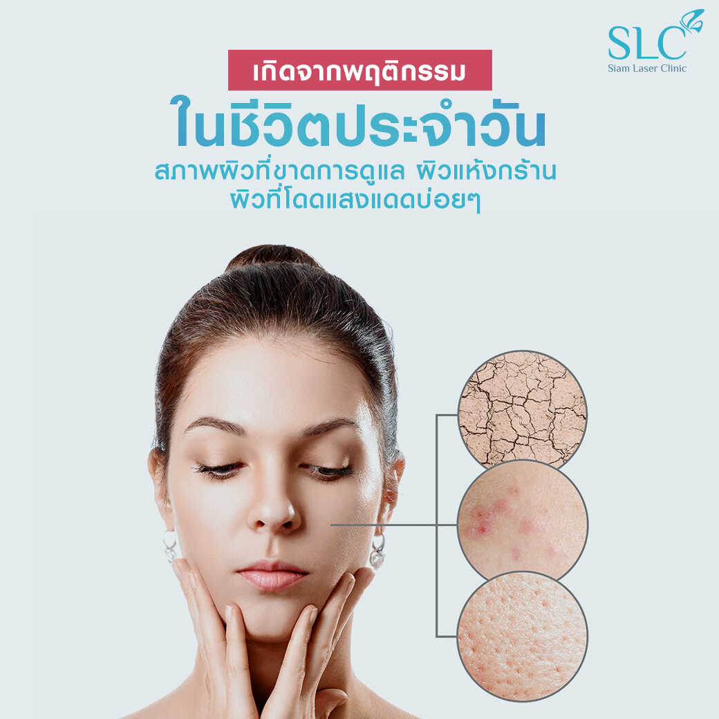 สารเติมเต็ม_ร่องแก้ม_Cheek_Filler