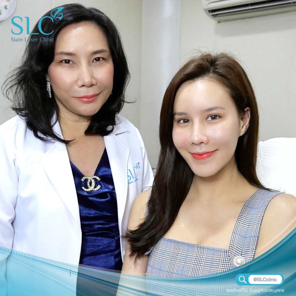 สารเติมเต็ม_ร่องแก้ม_Cheek_Filler