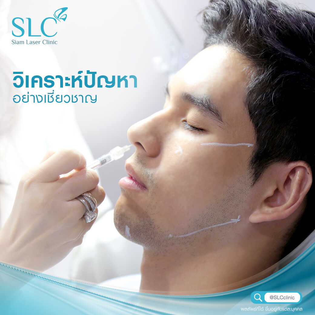 สารเติมเต็ม_ร่องแก้ม_Cheek_Filler