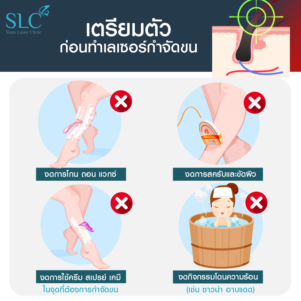 เลเซอร์กำจัดขน_Laser Hair Removal