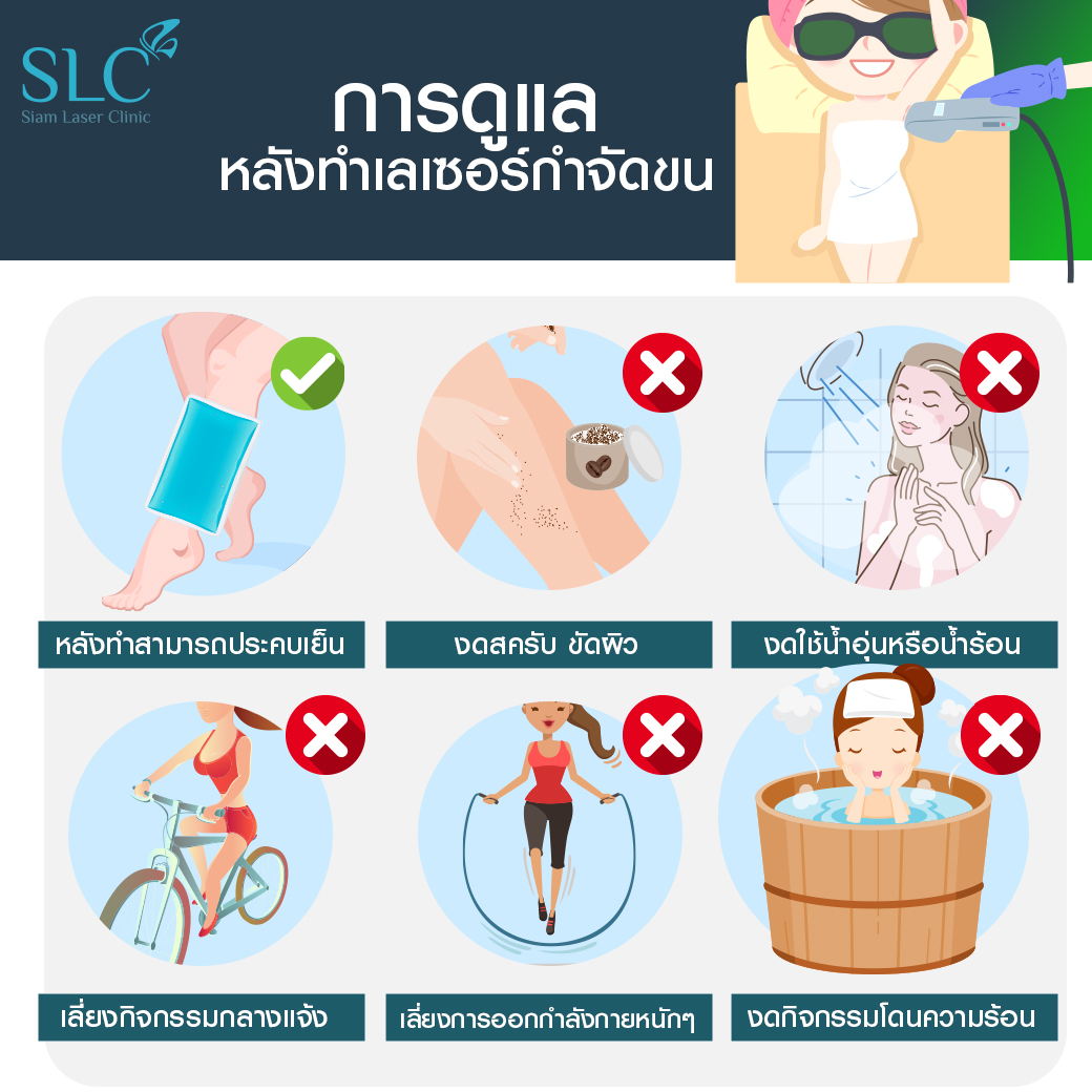 Hair Laser Removal_เลเซอร์ขน กำจัดขน