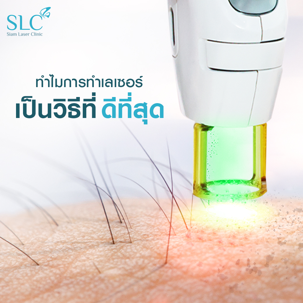 Hair Laser Removal_เลเซอร์ขน กำจัดขน