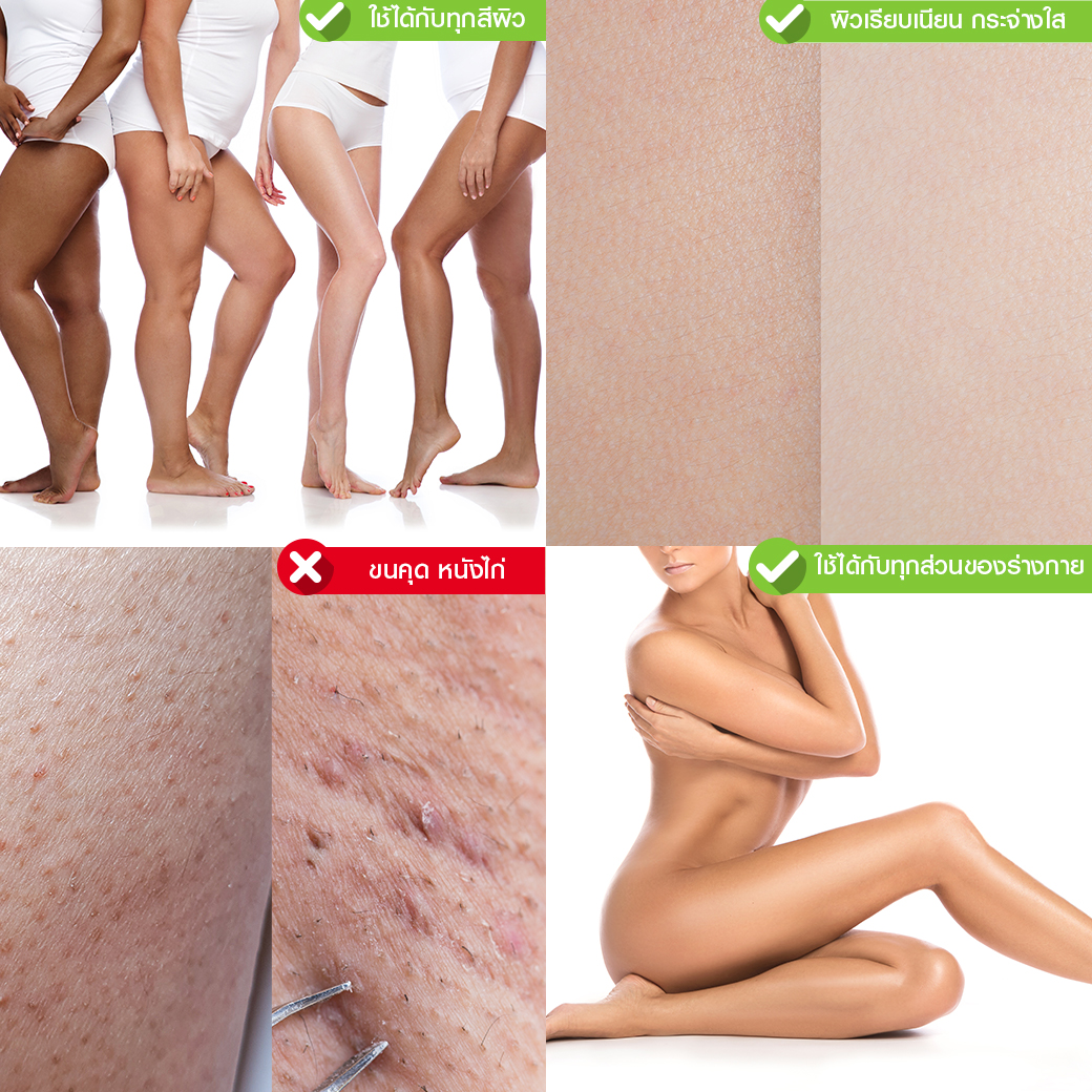 Hair Laser Removal_เลเซอร์ขน กำจัดขน