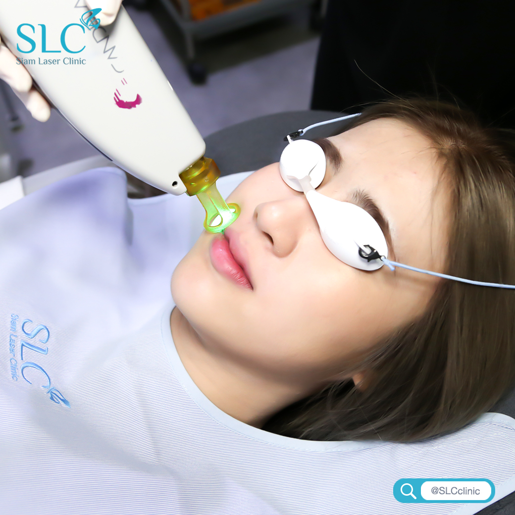 เลเซอร์กำจัดขน_Laser Hair Removal