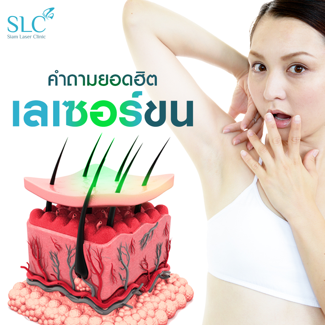 Hair Laser Removal_เลเซอร์ขน กำจัดขน