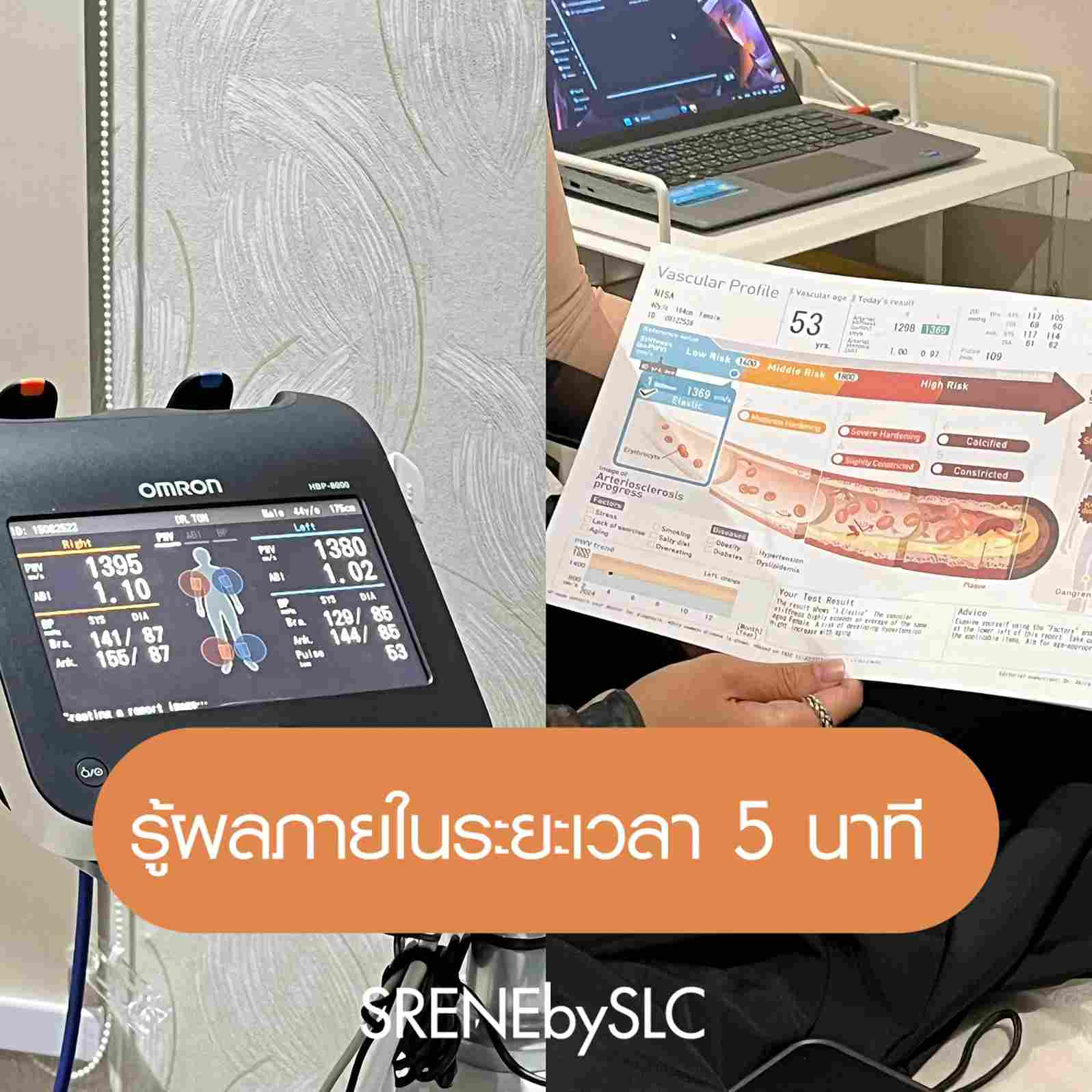 หลอดเลือดสมองตีบ,หลอดเลือดหัวใจตีบ,อาการ stroke,หลอดเลือดหัวใจตีบ อาการ,อายุหลอดเลือด,ตรวจอายุหลอดเลือด,ตรวจหลอดเลือด,เครื่อง ABI,อาการหลอดเลือดหัวใจตีบ,อาการหลอดเลือดสมองตีบ,stroke อาการ,s'rene by slc,s'rene,คลินิกสุขภาพ,คลินิกดูแลสุขภาพ,เวลเนส,wellness