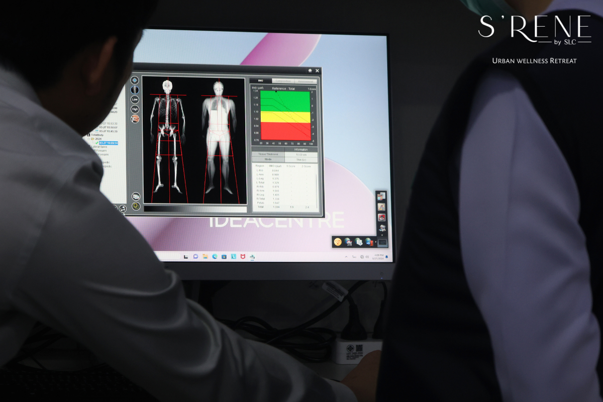 DEXA SCAN SRENE BY SLC 