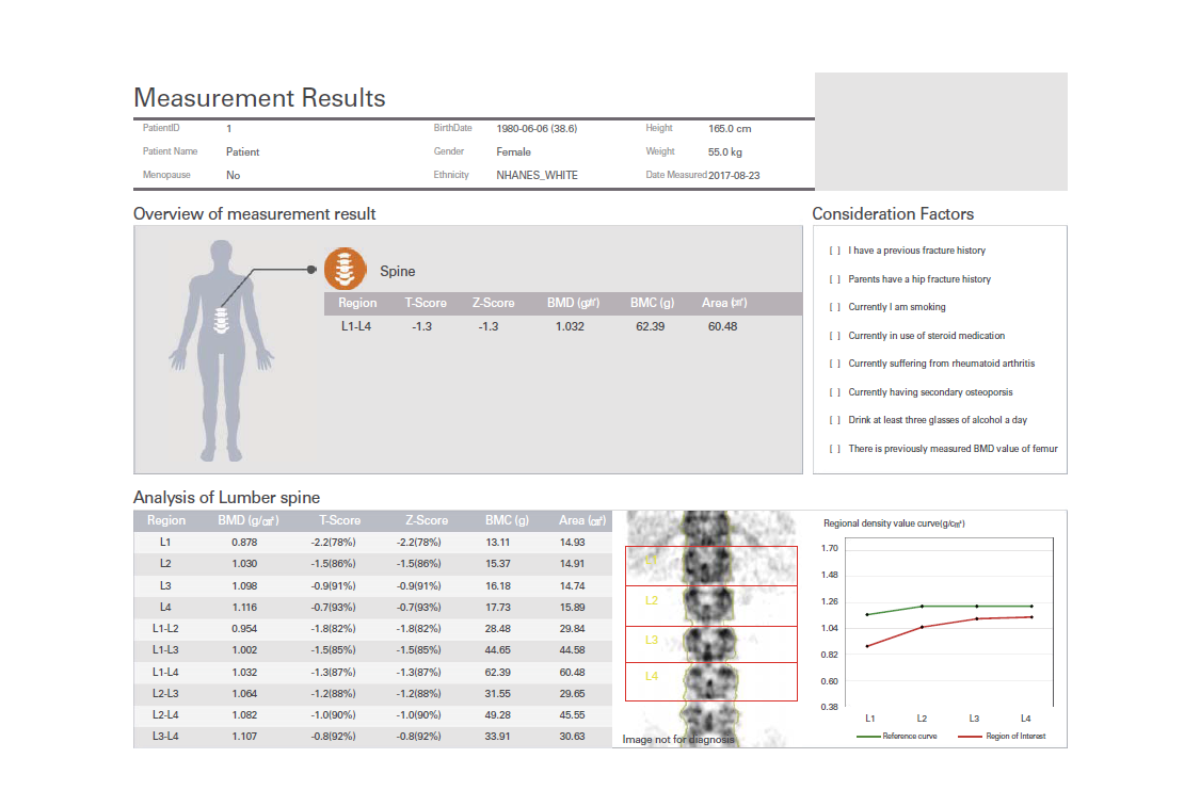 DEXA SCAN SRENE BY SLC 