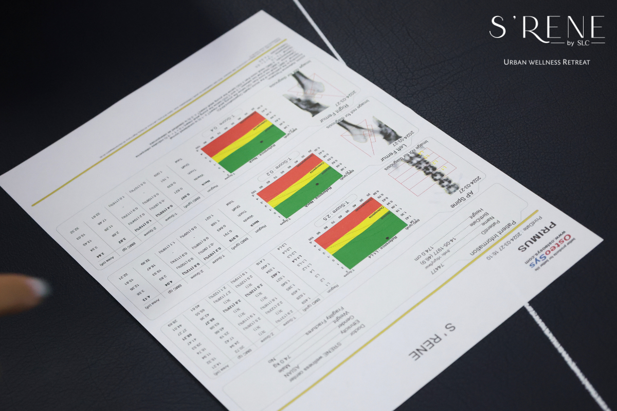 DEXA SCAN SRENE BY SLC 