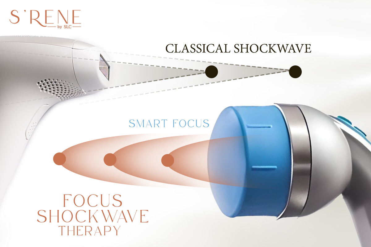 Focus Shockwave Therapy แก้ปัญหาอาการปวดเรื้อรัง และโรคหย่อนสมรรถภาพทางเพศ