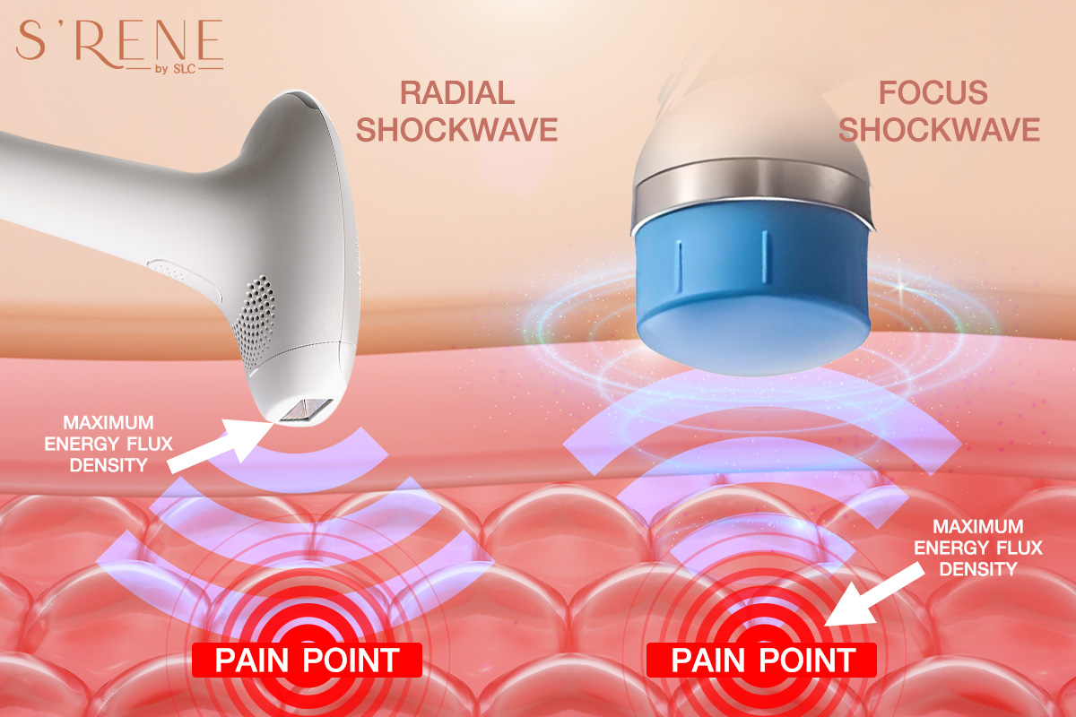 Focus Shockwave Therapy แก้ปัญหาอาการปวดเรื้อรัง และโรคหย่อนสมรรถภาพทางเพศ
