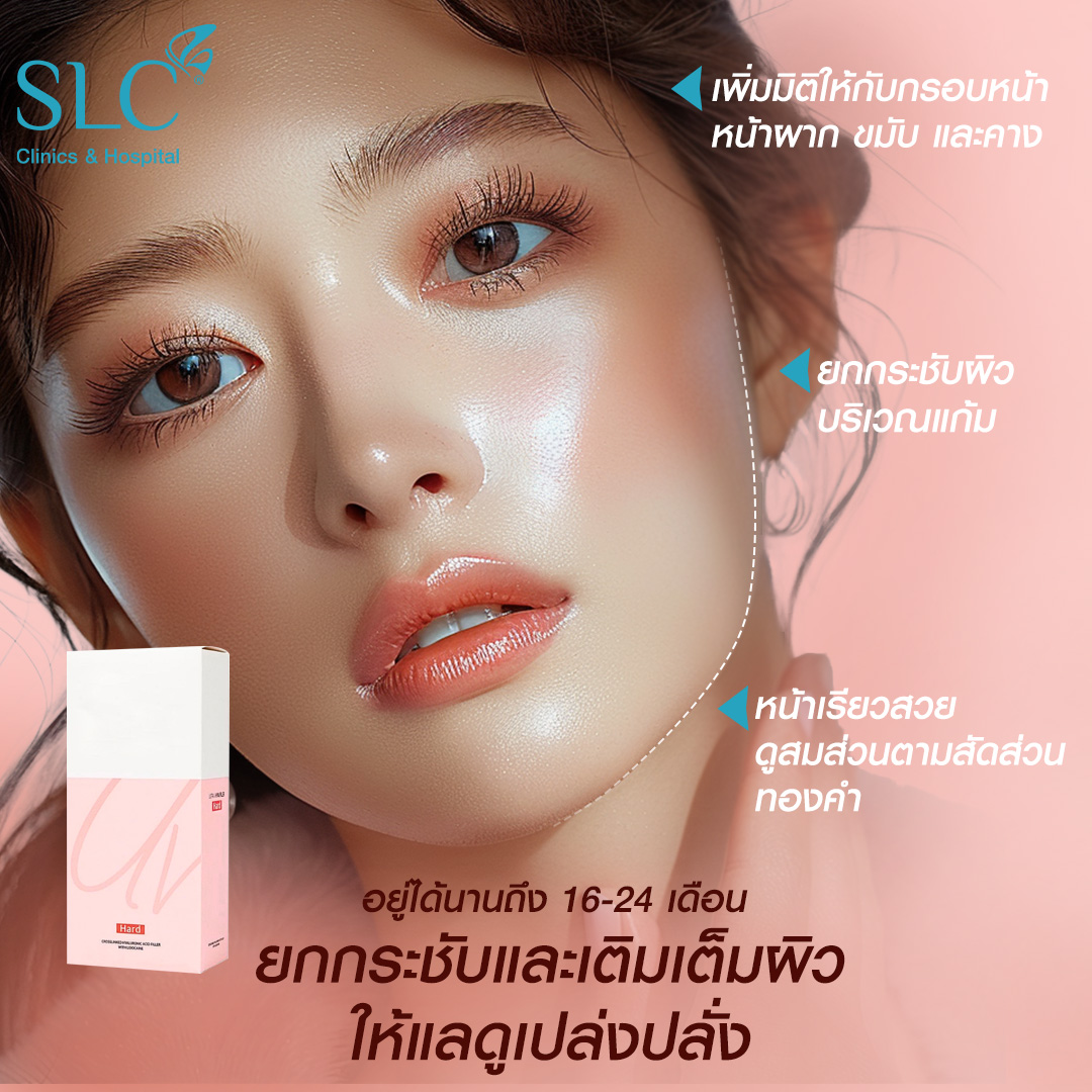 Hyal filler คืออะไร, hyaluron filler, filler hyaluronic acid, ultra v hyal filler, hya filler คือ, รีวิว Hyal filler, Hyal filler ช่วยอะไร,  Hyal filler 