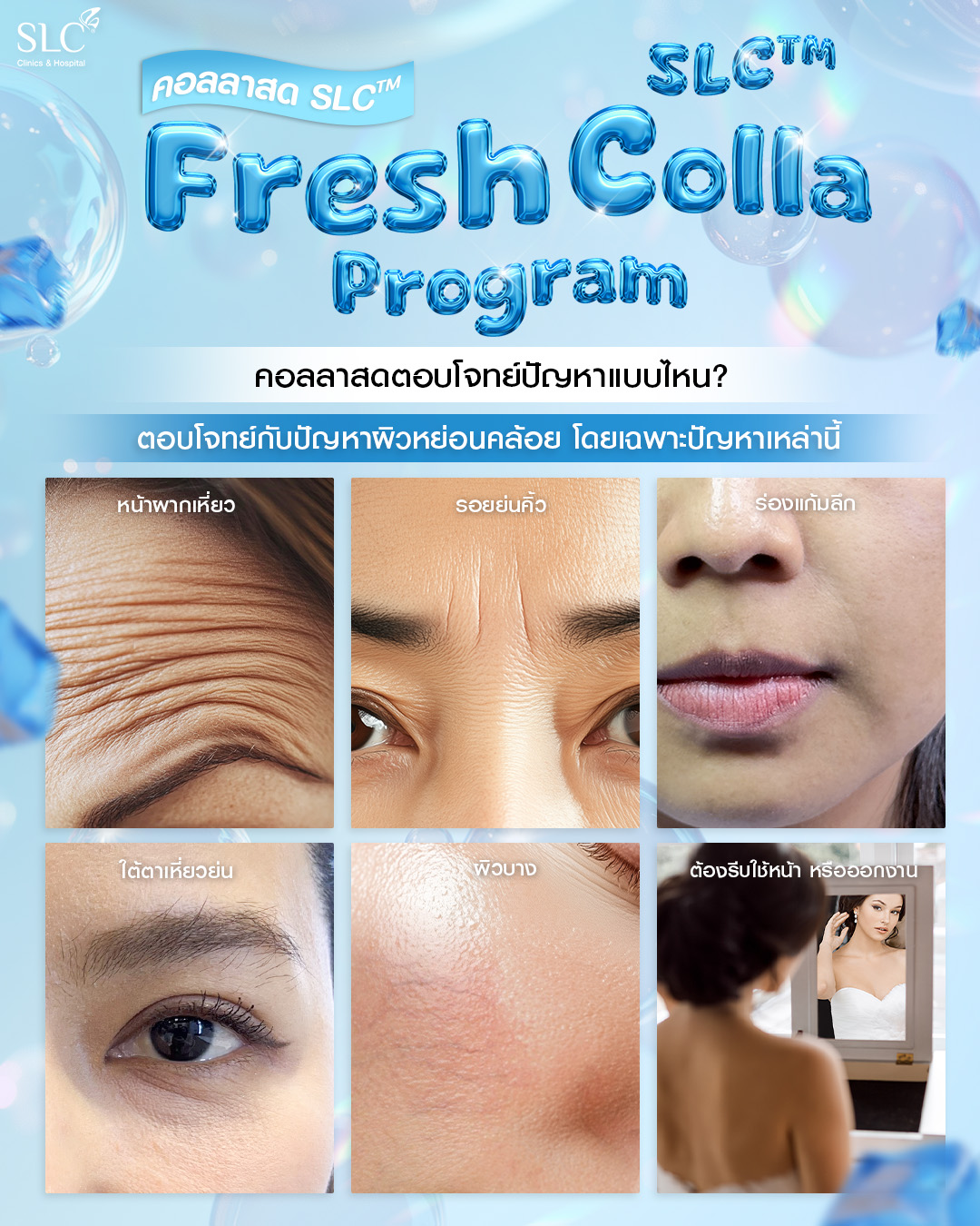  Fresh Colla SLC, Collaju, คอลลาสด SLC, ตัวช่วยกระตุ้นคอลลาเจน
