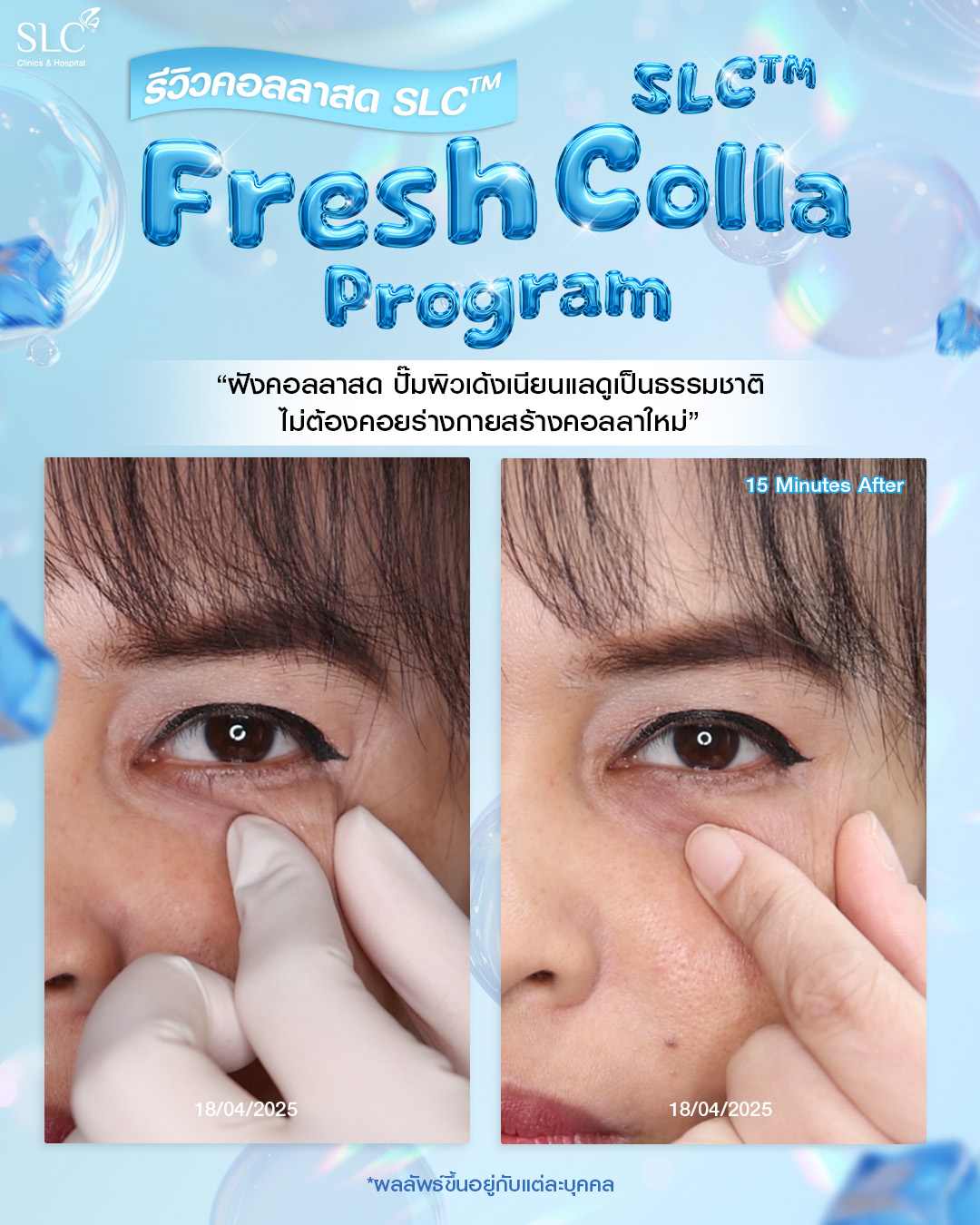  Fresh Colla SLC, Collaju, คอลลาสด SLC, ตัวช่วยกระตุ้นคอลลาเจน