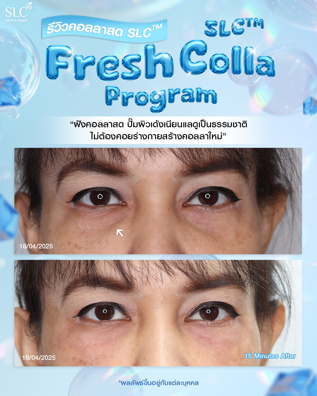  Fresh Colla SLC, Collaju, คอลลาสด SLC, ตัวช่วยกระตุ้นคอลลาเจน