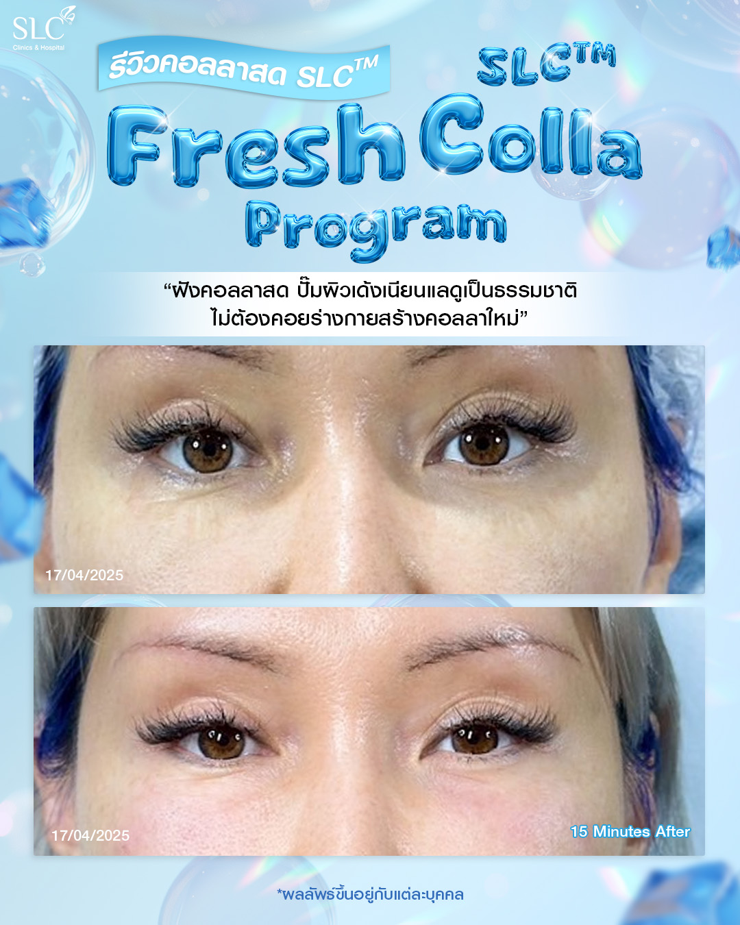  Fresh Colla SLC, Collaju, คอลลาสด SLC, ตัวช่วยกระตุ้นคอลลาเจน