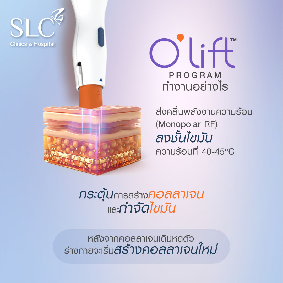 การทำงานของ O'lift™ Program