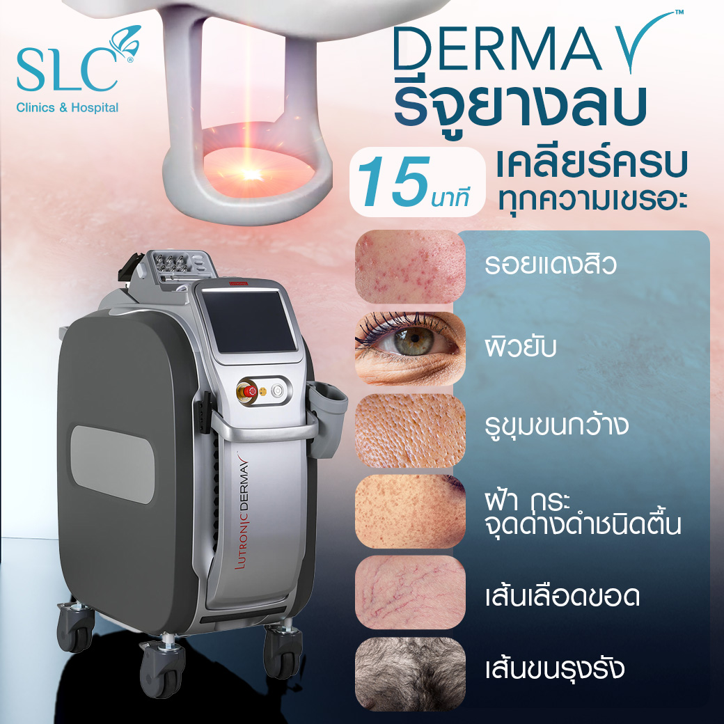 Derma V คืออะไร , Derma V ดีไหม