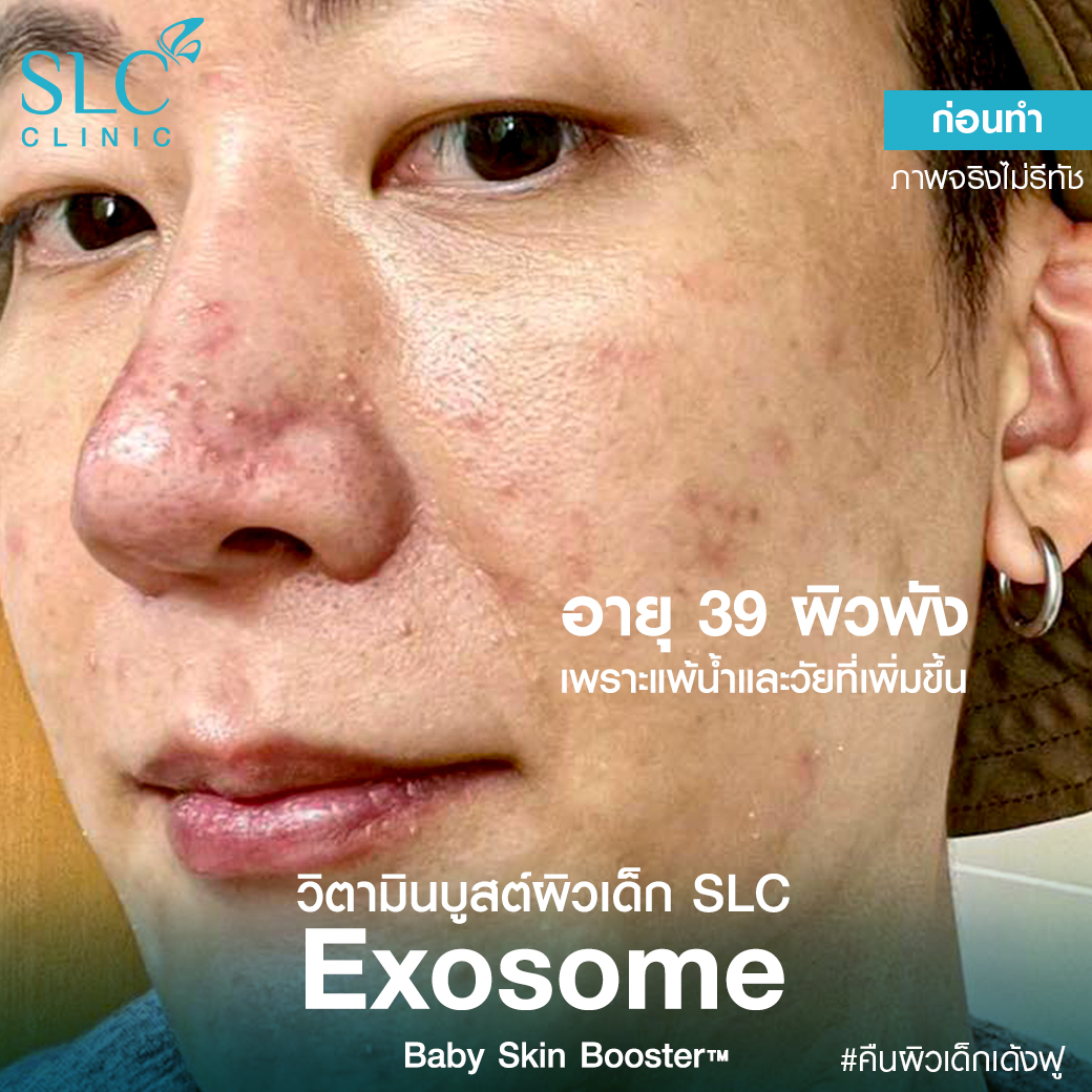 หน้าเนียน หน้าเด็ก รีวิววิตามินบูสต์ผิวเด็ก SLC  Baby Skin Booster วิตามินผิวหน้า เบบี้ สกิน บูสเตอร์