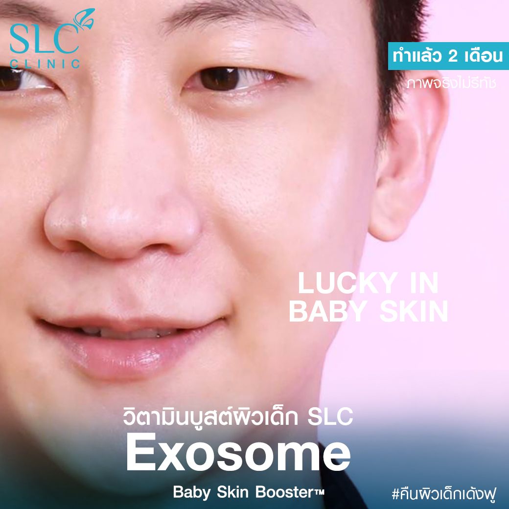 หน้าเนียน หน้าเด็ก รีวิววิตามินบูสต์ผิวเด็ก SLC Exosome Baby Skin Booster วิตามินผิวหน้า เอ็กซ์โซโซม เบบี้ สกิน บูสเตอร์