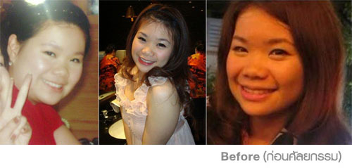 แนต Makeover by SLC