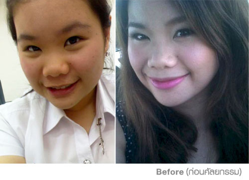 แนต Makeover by SLC