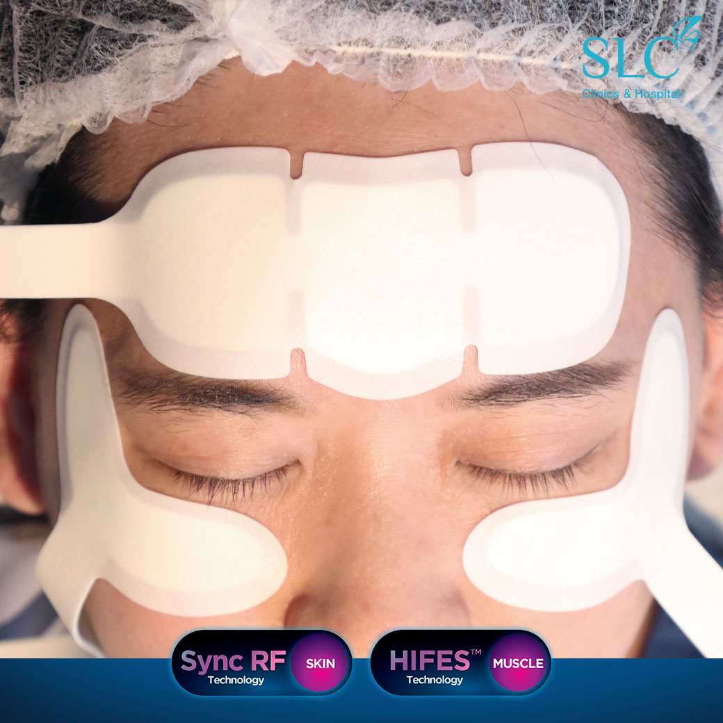 SLC Clinic, EMFACE Eyes Program, อบรมแพทย์ SLC, ยกกระชับใต้ตา