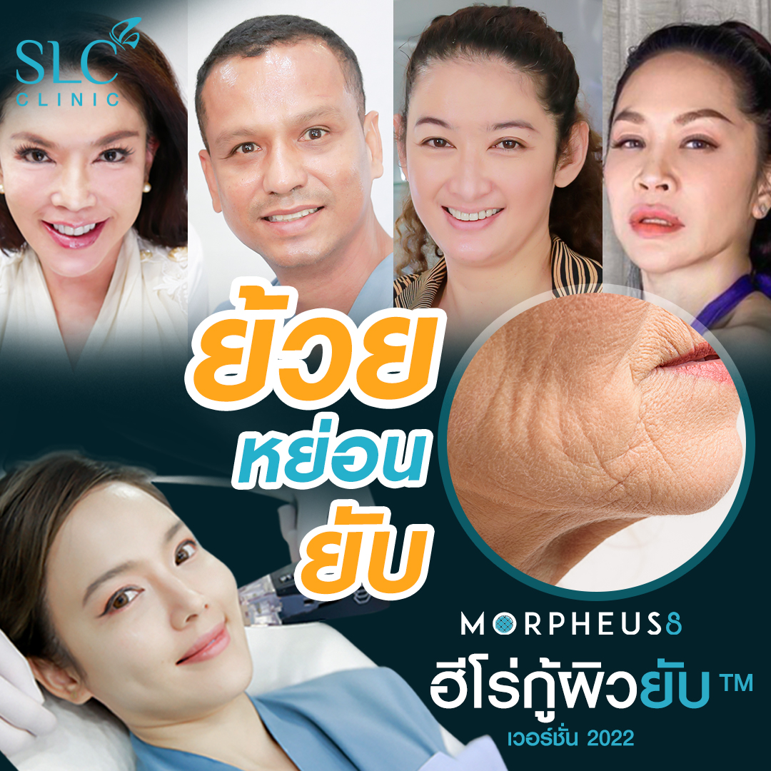 Morpheus8_ยกกระชับผิว