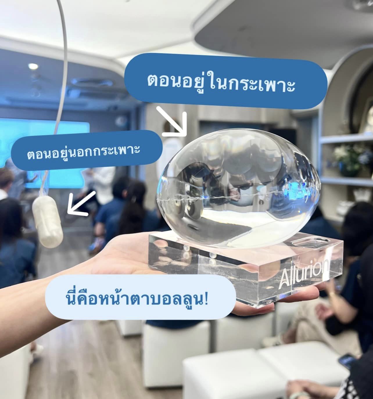  กลืนบอลลูนลดน้ำหนักSLC,บอลลูนลดน้ำหนัก,15 Minutes Balloon™,ลดน้ำหนัก,Allurion Program