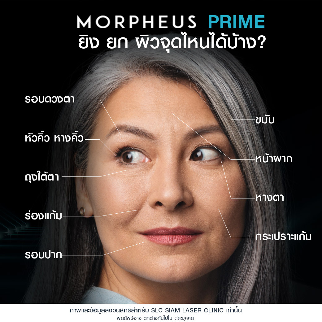 Morpheus Prime,ยกกระชับผิว,ยกคิ้ว,ยกหางตา