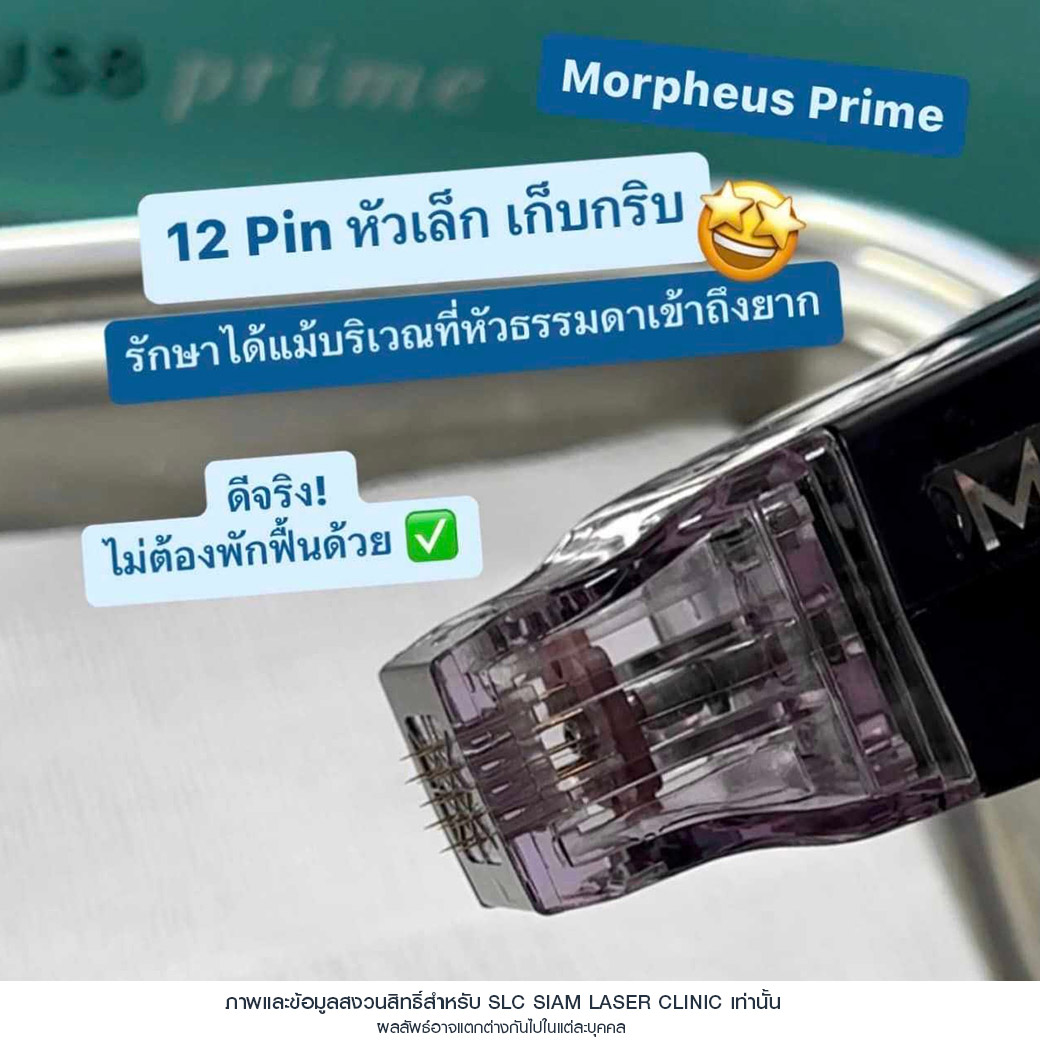 Morpheus Prime,ยกกระชับผิว,ยกคิ้ว,ยกหางตา