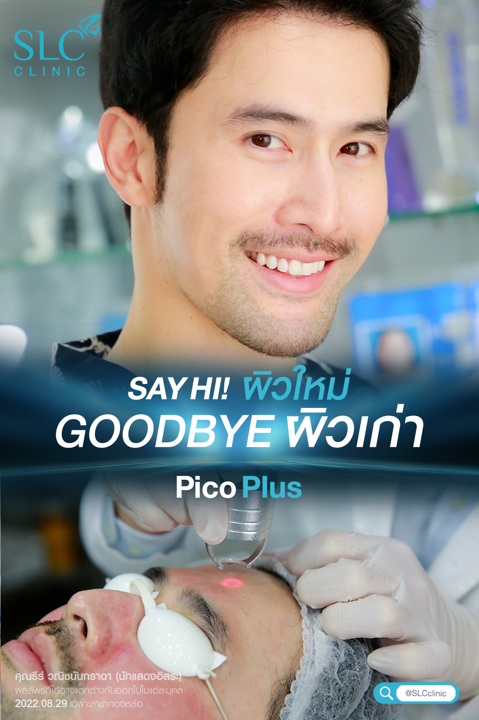 Pico Plus Laser, รีทัชหน้าใส,รักษาหลุมสิว,เลเซอร์หน้าใส,รักษาฝ้า กระ, รักษาสิว,ลบรอยสัก