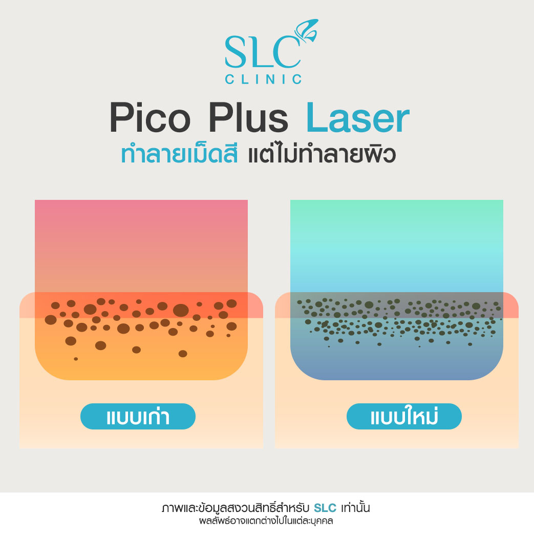 Pico Plus Laser, รีทัชหน้าใส,รักษาหลุมสิว,เลเซอร์หน้าใส,รักษาฝ้า กระ, รักษาสิว,ลบรอยสัก