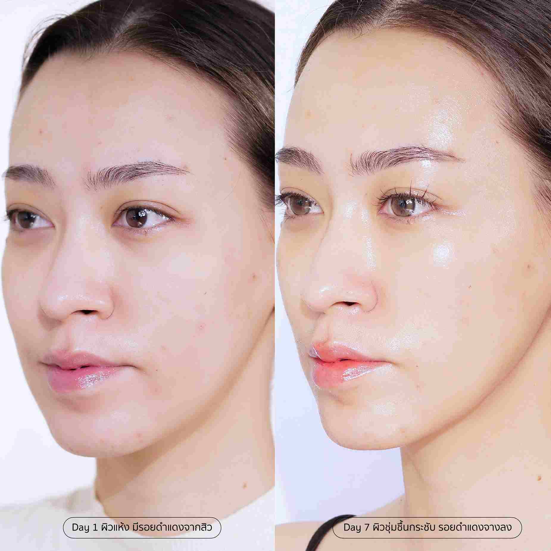 SLC Reju Glass Skin Serum,รีจูรัน,เซรั่มรีจูรัน,ซีรั่มรีจูรัน,เซรั่มรีจูรันรีวิว,SLC Reju,SLC Reju Serum,ซีรัมรีจูฟื้นฟูผิว,เซรั่มฟื้นฟูผิว,ซีรั่มผิวไบร์ท,เซรั่มผิวไบร์ท