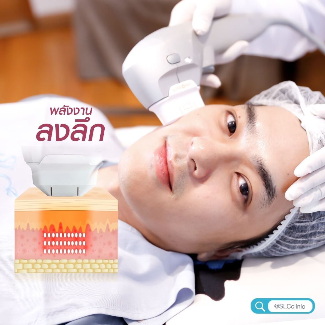 ยกกระชับ Ultralift