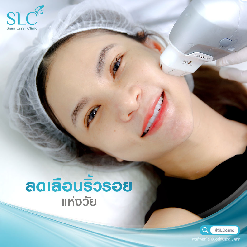 ยกกระชับ Ultralift