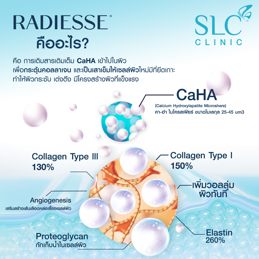 RADIESSE® คืออะไร เรเดียสคืออะไร เรเดี๊ยซ