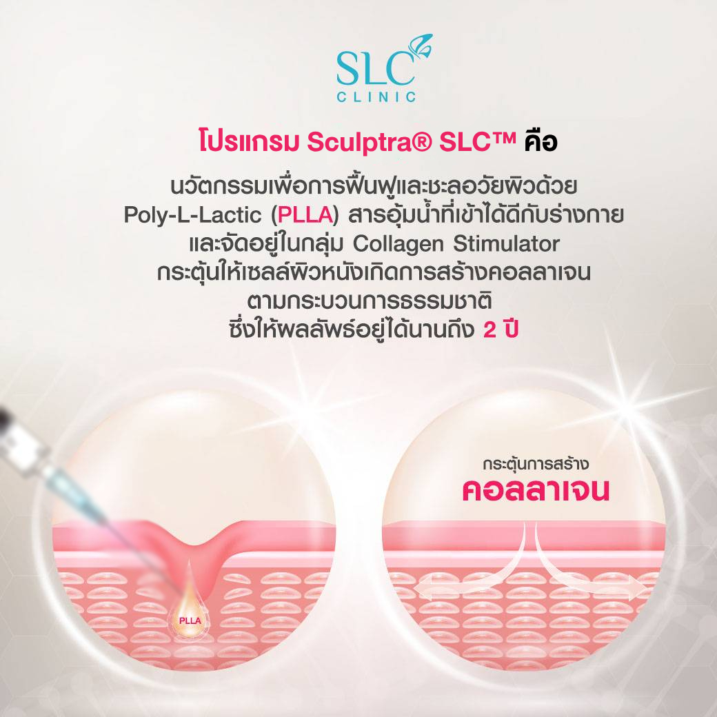 Sculptra®, ริ้วรอย, หน้าเหี่ยว, ผิวแห้งเหมือนคนแก่, ครีมลดริ้วรอย, ผิวหย่อนคล้อย, ยกกระชับผิว