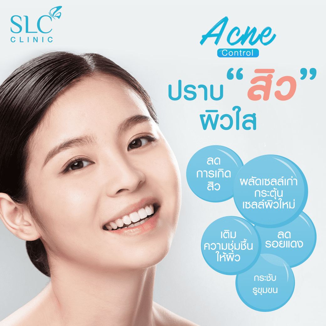 Acne Control_รักษาสิว ผิวใส