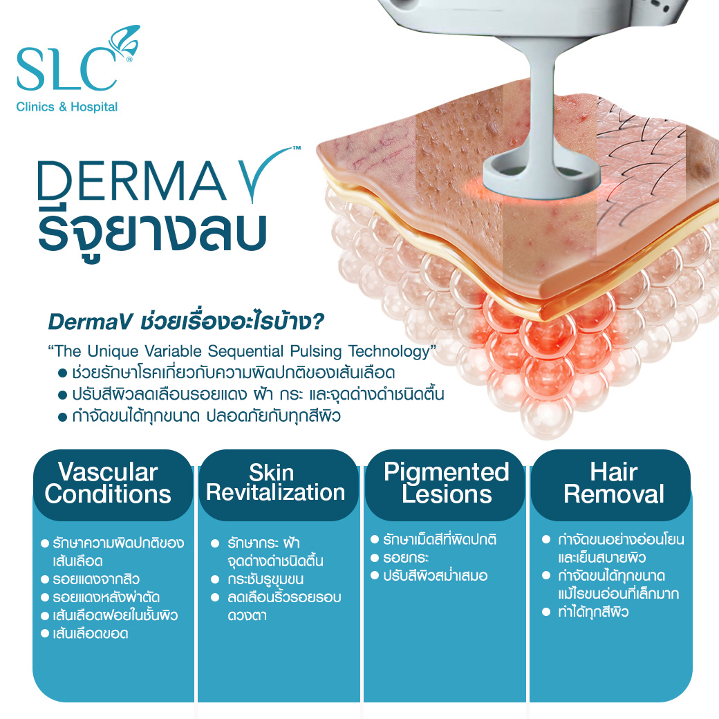 DermaV , Derma V, รีจูยางลบ , รอยแดงแก้ได้ , เลเซอร์ลบรอยแดง , รักษาเส้นเลือดขอด , เลเซอร์กำจัดขน , เลเซอร์ขน