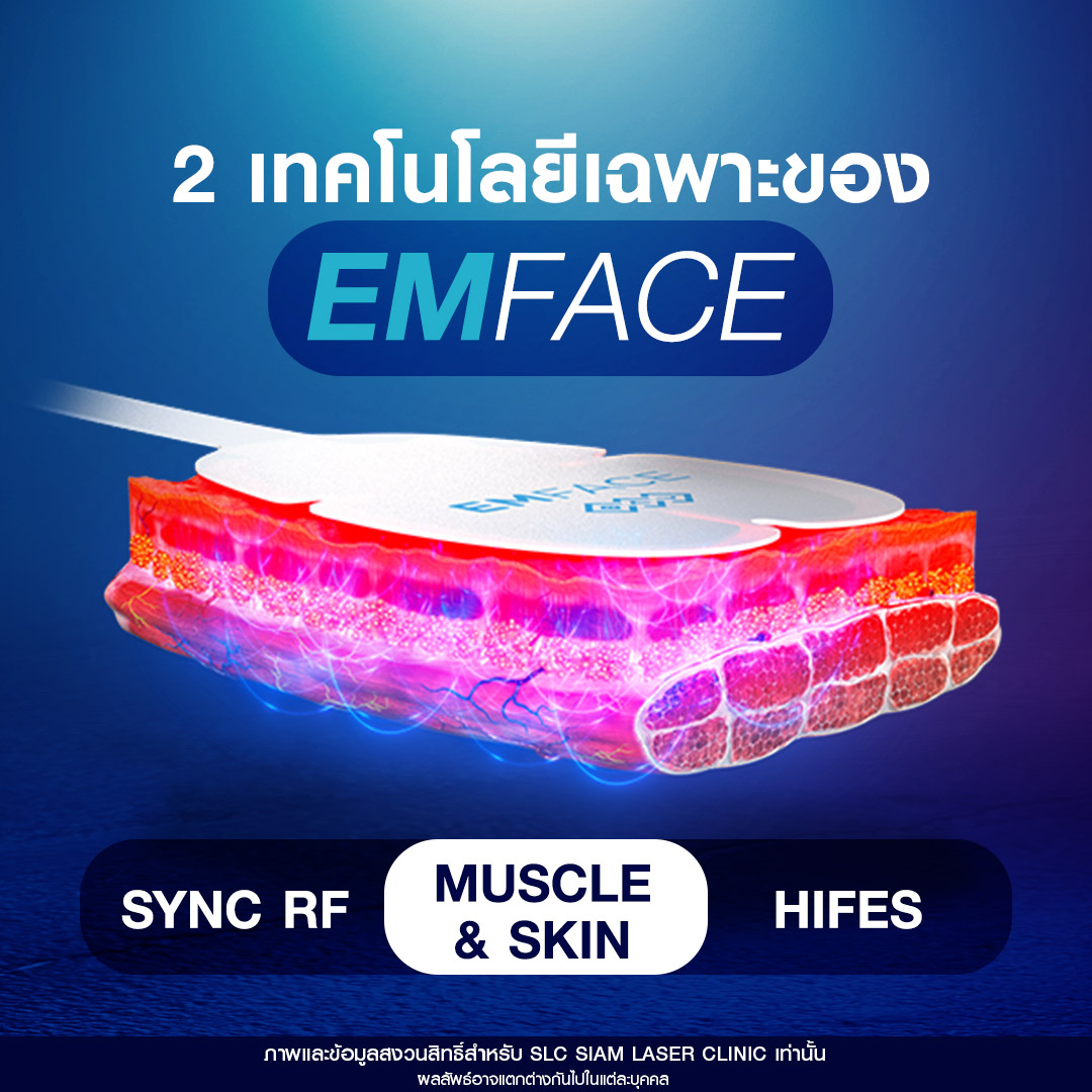 Emface, ยกกระชับผิว, ยกกระชับหน้าเด็ก, ยกผิว