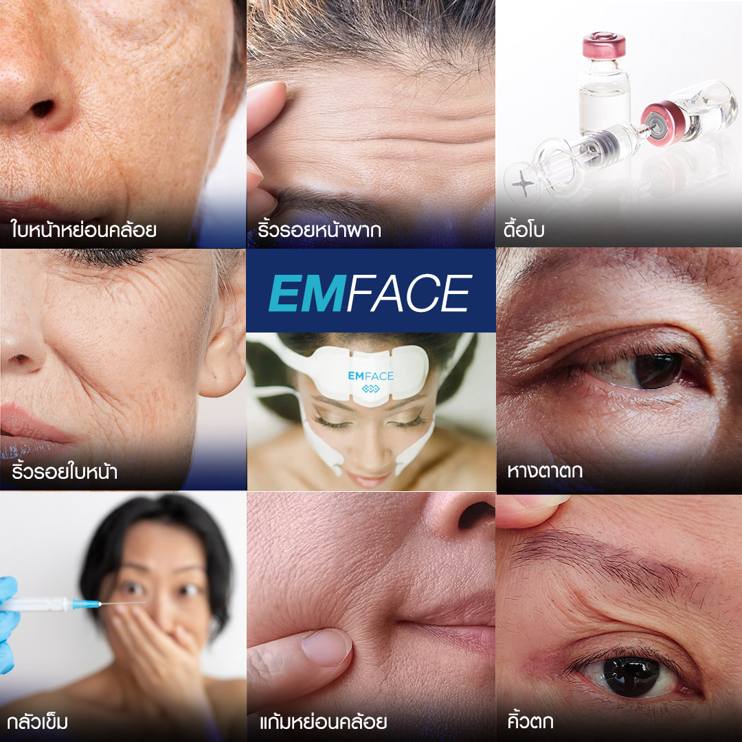 Emface, ยกกระชับผิว, ยกกระชับหน้าเด็ก, ยกผิว